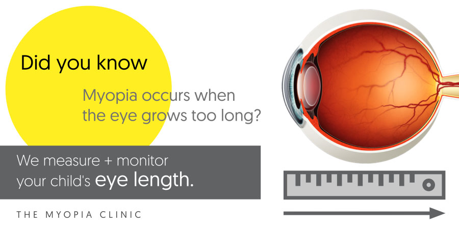 Unlike most optometrists, we measure your child's eye length as part of our assessment. Because eye length matters when it comes to managing your child's myopia and assessing the risk of lifetime complications from abnormal eye growth.