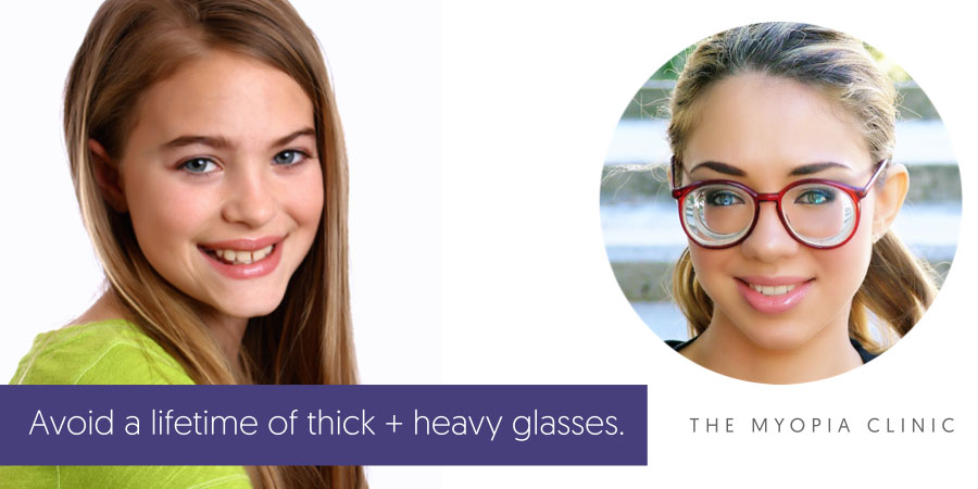 Avoid a lifetime of Coke bottle thick and heavy glasses with myopia control from a young age. Thick glasses are uncomfortable to wear and less cosmetically attractive.