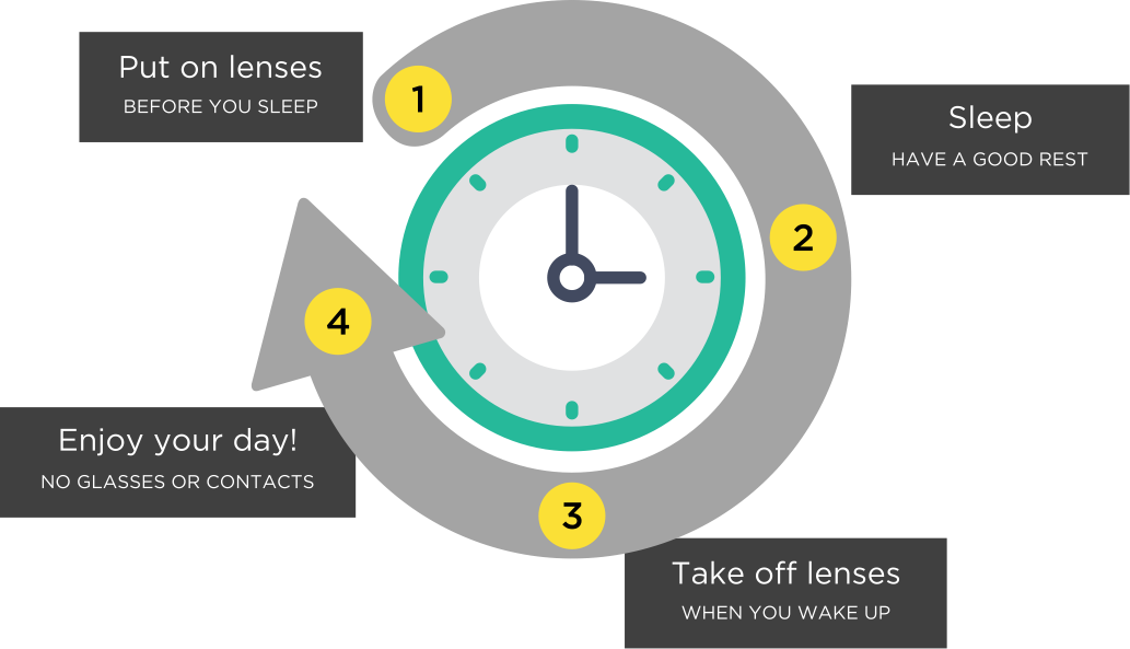 Ortho-K are corneal reshaping lenses worn during sleep to correct and restore clear vision.